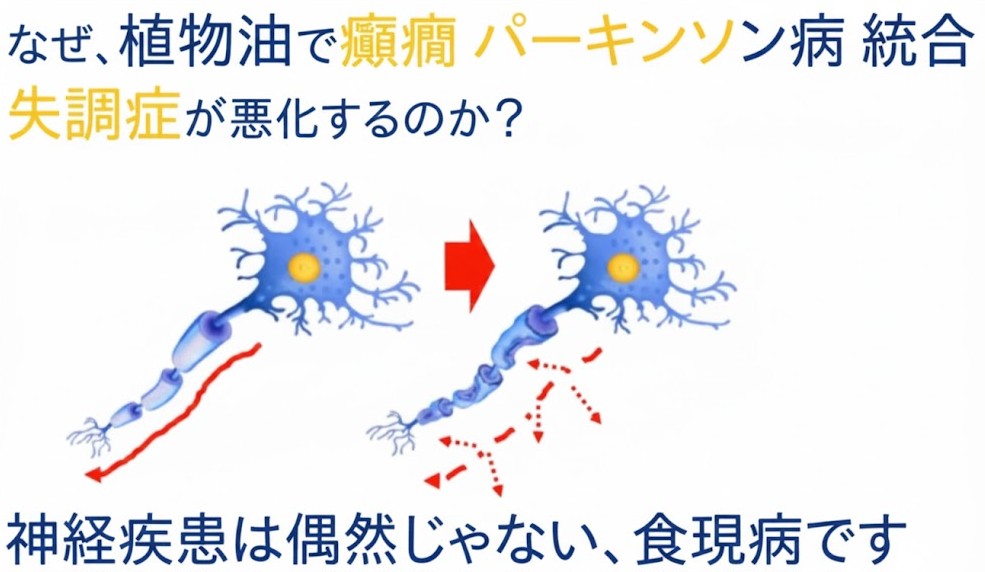 植物油のアルデヒドがミエリン鞘を破壊