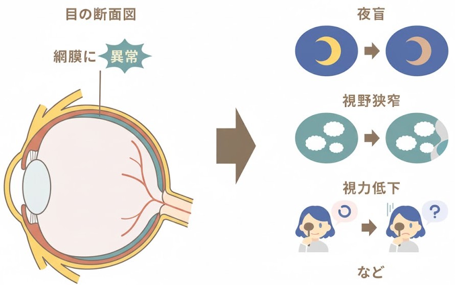 網膜色素変性症の進行抑制へ鍼灸・指圧マッサージで血流改善